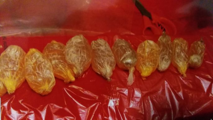 Mujer detenida  con cocaína en el estómago.