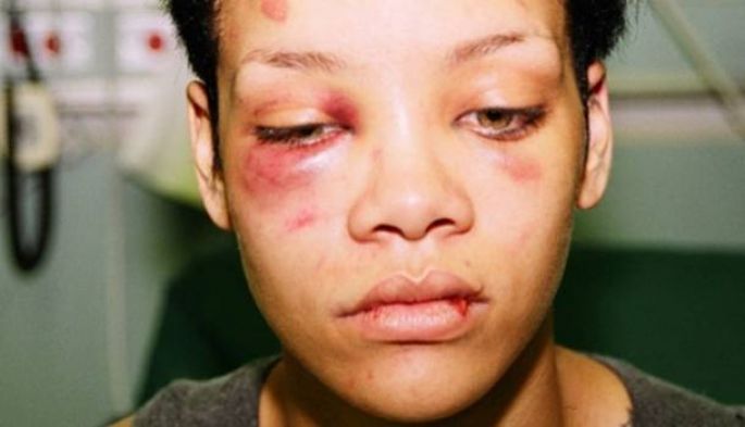 El cantante Chris Brown confiesa cómo fue la noche en la que agredió a Rihanna.