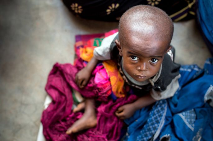 Unos 7,7 millones de personas sufren hambre en la República Democrática del Congo.