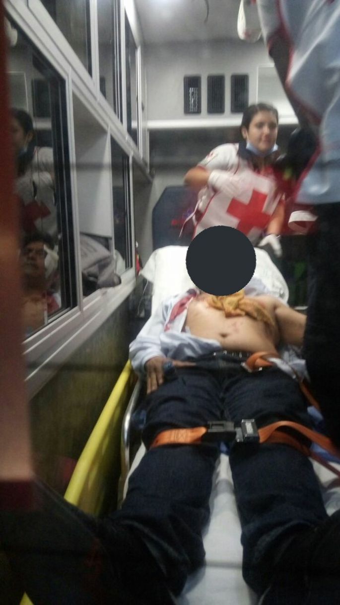 Balean a hombre en Polanco