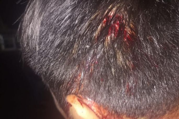 Grupos de choque hieren gravemente a un policía