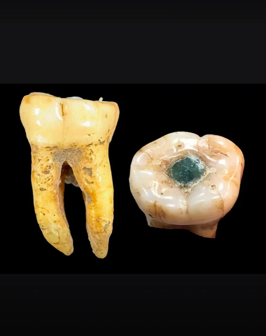 Mayas habrían realizado tratamientos dentales terapéuticos hace más de mil años, revela investigación de la UADY